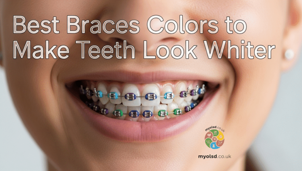 Best Braces Colors to Make Teeth Look Whiter